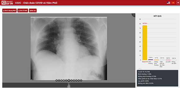 Dtu Develops X Ray And Ct App For Covid 19 Detection Tin Tức đại Học Duy Tan