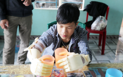 DTU Gives Robotic Arms to Disabled Students in Quang Nam